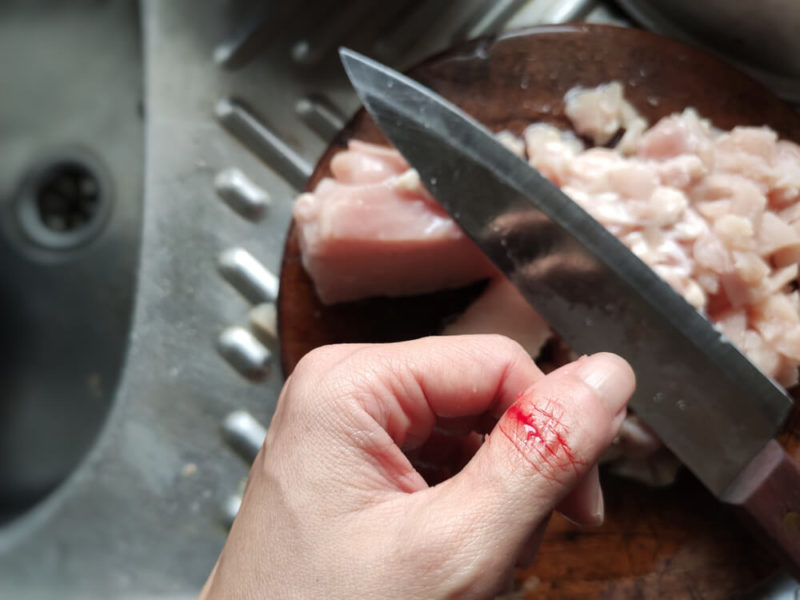 Common-Restaurant-Injuries